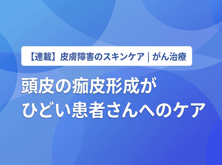 どうする? 頭皮に痂皮形成がひどい患者さん【PR】のサムネイル画像