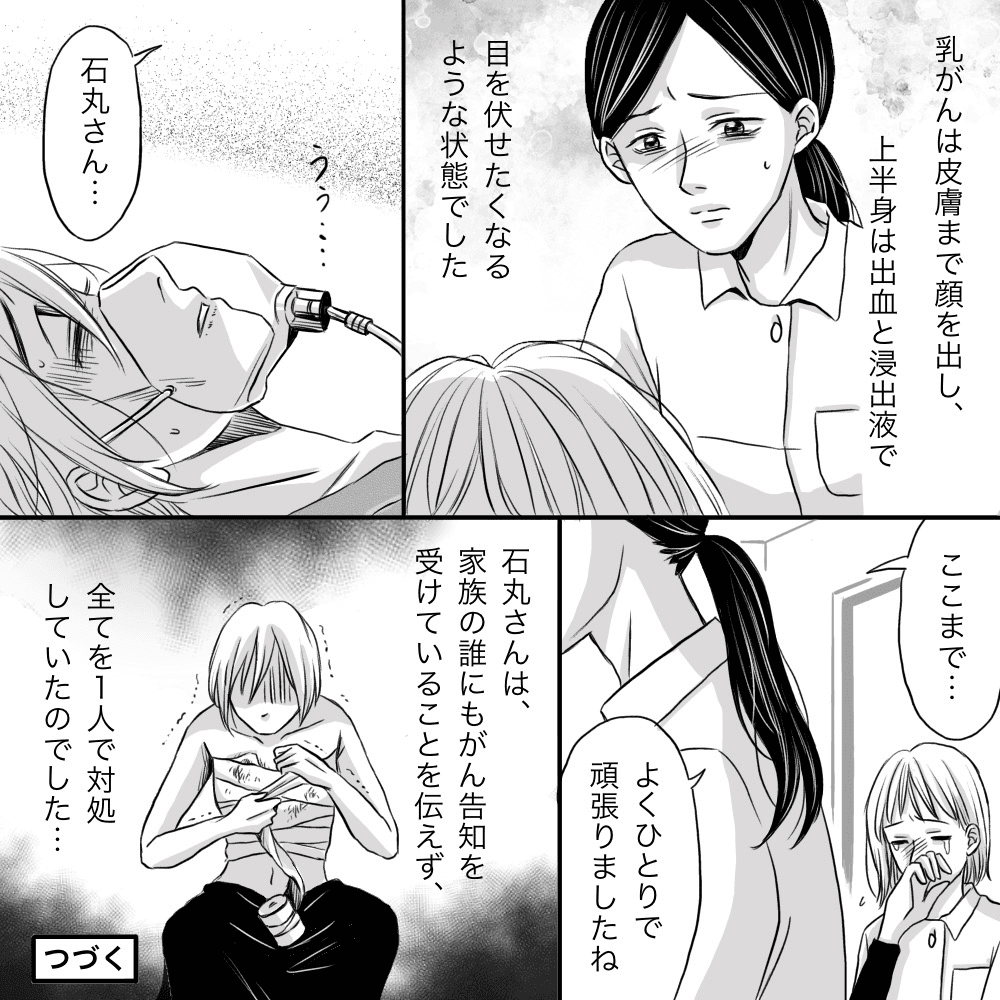 胸部は癌が皮膚に浸潤しており酷い状態で、患者は家族の誰にもがん告知をせず一人で全て対処していたのだった