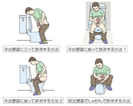 便器での排泄物を捨てる姿勢の例